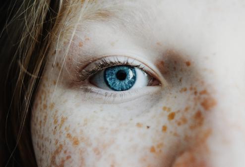Close up of right eye of girl with freckles.