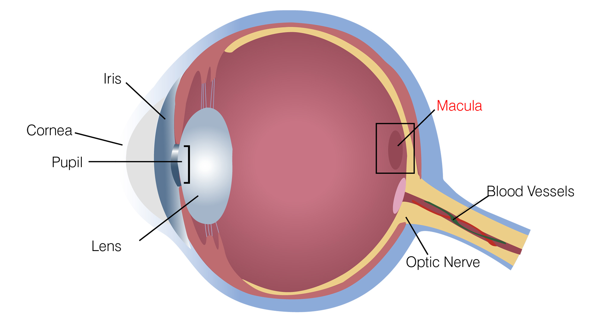 Diagram of eye with Macular Degeneration